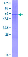 HSD17B7 / PRAP Protein - 12.5% SDS-PAGE of human HSD17B7 stained with Coomassie Blue