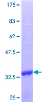HSD17B7 / PRAP Protein - 12.5% SDS-PAGE Stained with Coomassie Blue.
