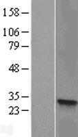 HSD17B8 / RING2 Protein - Western validation with an anti-DDK antibody * L: Control HEK293 lysate R: Over-expression lysate