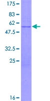 HSD17B8 / RING2 Protein - 12.5% SDS-PAGE of human HSD17B8 stained with Coomassie Blue