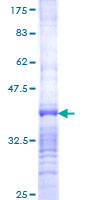HSD17B8 / RING2 Protein - 12.5% SDS-PAGE Stained with Coomassie Blue.