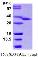 HSD17B8 / RING2 Protein