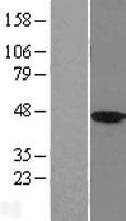 HSD2 / HSD11B2 Protein - Western validation with an anti-DDK antibody * L: Control HEK293 lysate R: Over-expression lysate