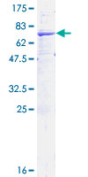 HSD2 / HSD11B2 Protein - 12.5% SDS-PAGE of human HSD11B2 stained with Coomassie Blue