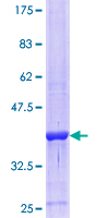 HSD2 / HSD11B2 Protein - 12.5% SDS-PAGE Stained with Coomassie Blue.