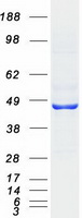 HSD2 / HSD11B2 Protein - Purified recombinant protein HSD11B2 was analyzed by SDS-PAGE gel and Coomassie Blue Staining