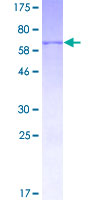 HSD3B1 Protein - 12.5% SDS-PAGE of human HSD3B1 stained with Coomassie Blue