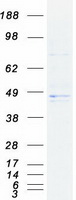 HSD3B1 Protein - Purified recombinant protein HSD3B1 was analyzed by SDS-PAGE gel and Coomassie Blue Staining