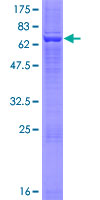 HSD3B2 Protein - 12.5% SDS-PAGE of human HSD3B2 stained with Coomassie Blue