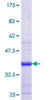 HSD3B2 Protein - 12.5% SDS-PAGE Stained with Coomassie Blue.