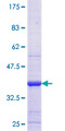 HSD3B2 Protein - 12.5% SDS-PAGE Stained with Coomassie Blue.