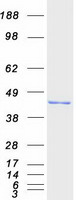 HSD3B2 Protein - Purified recombinant protein HSD3B2 was analyzed by SDS-PAGE gel and Coomassie Blue Staining