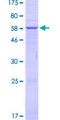 HSD3B7 Protein - 12.5% SDS-PAGE of human HSD3B7 stained with Coomassie Blue