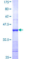 HSD3B7 Protein - 12.5% SDS-PAGE Stained with Coomassie Blue.
