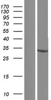 HSDL1 Protein - Western validation with an anti-DDK antibody * L: Control HEK293 lysate R: Over-expression lysate