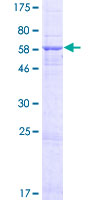 HSDL1 Protein - 12.5% SDS-PAGE of human HSDL1 stained with Coomassie Blue