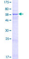 HSDL1 Protein - 12.5% SDS-PAGE of human HSDL1 stained with Coomassie Blue