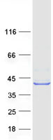 HSDL1 Protein - Purified recombinant protein HSDL1 was analyzed by SDS-PAGE gel and Coomassie Blue Staining