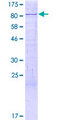 HSET / KIFC1 Protein - 12.5% SDS-PAGE of human KIFC1 stained with Coomassie Blue
