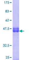 HSF1 Protein - 12.5% SDS-PAGE Stained with Coomassie Blue.
