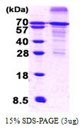 HSF1 Protein