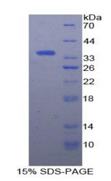 HSF1 Protein - Recombinant Heat Shock Transcription Factor 1 By SDS-PAGE