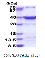 HSF2BP Protein