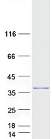 HSF2BP Protein - Purified recombinant protein HSF2BP was analyzed by SDS-PAGE gel and Coomassie Blue Staining