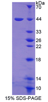 HSF4 Protein - Recombinant  Heat Shock Transcription Factor 4 By SDS-PAGE