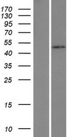 HSFY1 Protein - Western validation with an anti-DDK antibody * L: Control HEK293 lysate R: Over-expression lysate