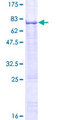 HSFY1 Protein - 12.5% SDS-PAGE of human HSFY1 stained with Coomassie Blue