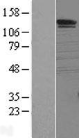 HSorCS / SORCS1 Protein - Western validation with an anti-DDK antibody * L: Control HEK293 lysate R: Over-expression lysate