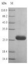 HSP90AB1 / HSP90 Alpha B1 Protein - (Tris-Glycine gel) Discontinuous SDS-PAGE (reduced) with 5% enrichment gel and 15% separation gel.