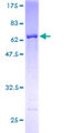 HSP90B1 / GP96 / GRP94 Protein - 12.5% SDS-PAGE of human TRA1 stained with Coomassie Blue