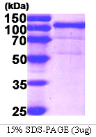 HSP90B1 / GP96 / GRP94 Protein