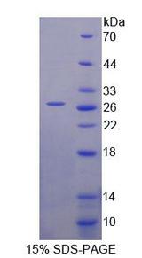 HSPA12B Protein - Recombinant Heat Shock 70kDa Protein 12B By SDS-PAGE