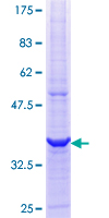 HSPA13 Protein - 12.5% SDS-PAGE Stained with Coomassie Blue.
