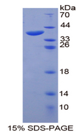 HSPA1A Protein - Recombinant  Heat Shock 70kDa Protein 1A By SDS-PAGE