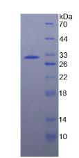 HSPA4 / APG-2 Protein - Recombinant Heat Shock 70kDa Protein 4 By SDS-PAGE