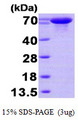 HSPA6 / HSP70B' Protein