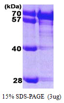 HSPA8 / HSC70 Protein
