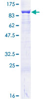 HSPA9 / Mortalin / GRP75 Protein - 12.5% SDS-PAGE of human HSPA9 stained with Coomassie Blue