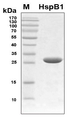HSPB1 / HSP27 Protein