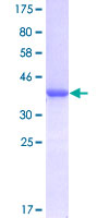 HSPB1 / HSP27 Protein - 12.5% SDS-PAGE Stained with Coomassie Blue.