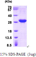 HSPB1 / HSP27 Protein