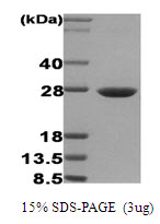 HSPB1 / HSP27 Protein