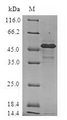 HSPB2 / HSP27 Protein - (Tris-Glycine gel) Discontinuous SDS-PAGE (reduced) with 5% enrichment gel and 15% separation gel.
