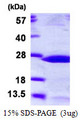 HSPB2 / HSP27 Protein