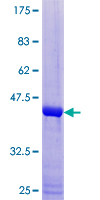 HSPB6 / HSP20 Protein - 12.5% SDS-PAGE of human HSPB6 stained with Coomassie Blue