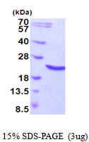 HSPB6 / HSP20 Protein